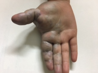Diagnose This Condition